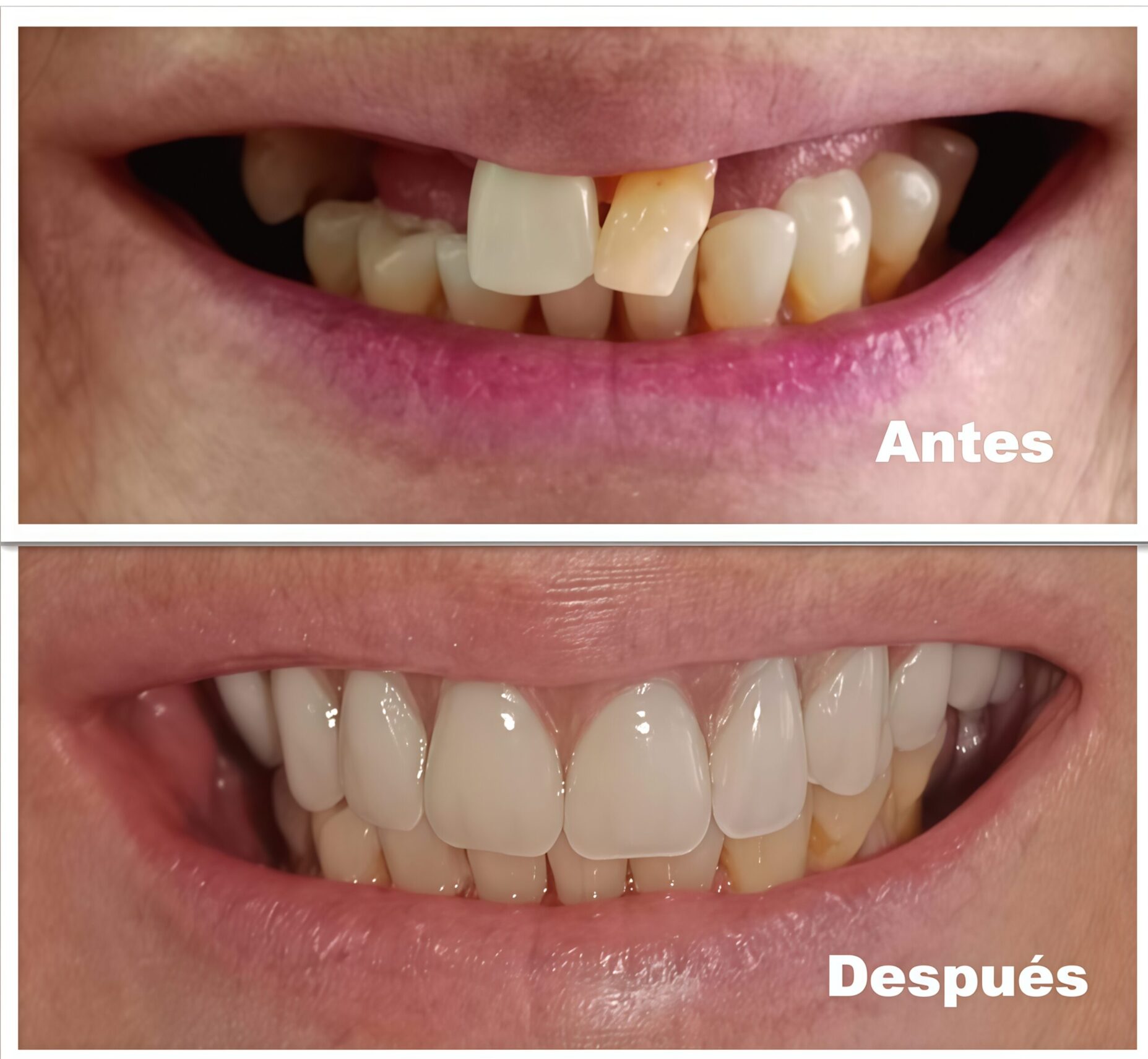 Airbrush-IMAGE-ENHANCER-1774564460673-1774564460674